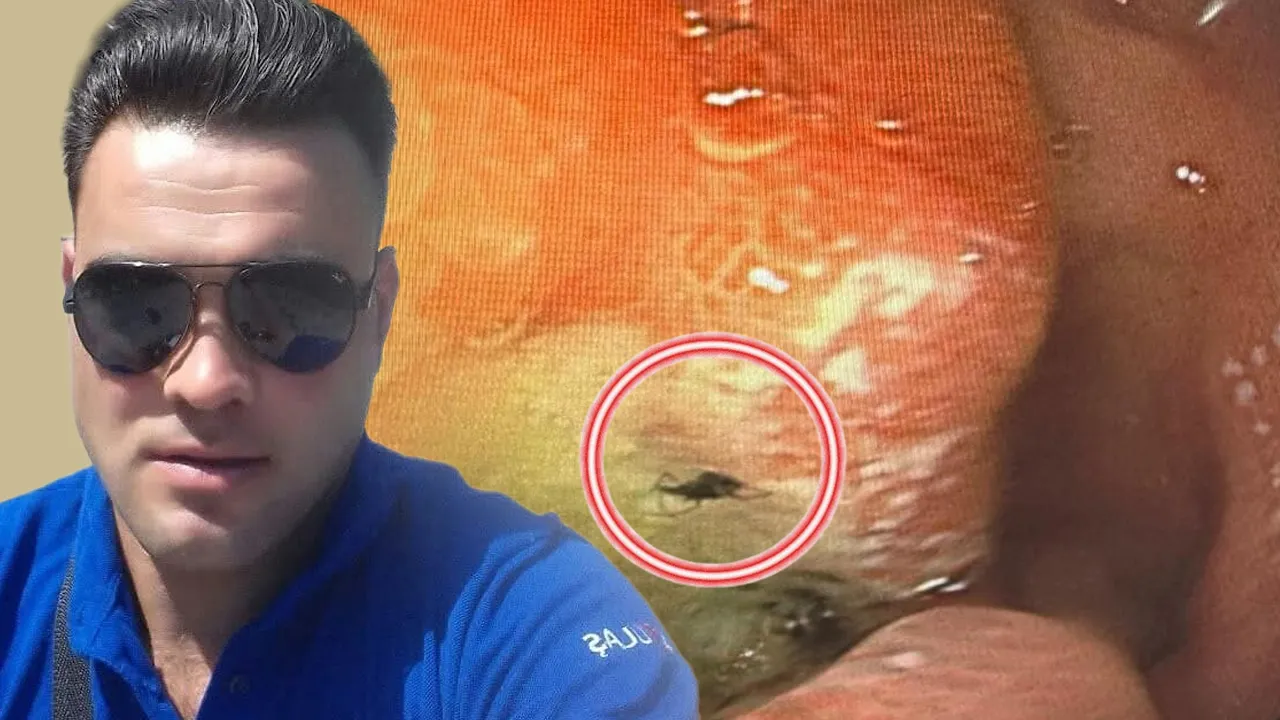 MİDESİNDEN CANLI BÖCEK ÇIKTI
