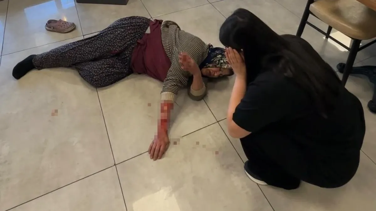 Afyonkarahisar'da can pazarı!  Başıboş köpek kadının kolunu kopardı