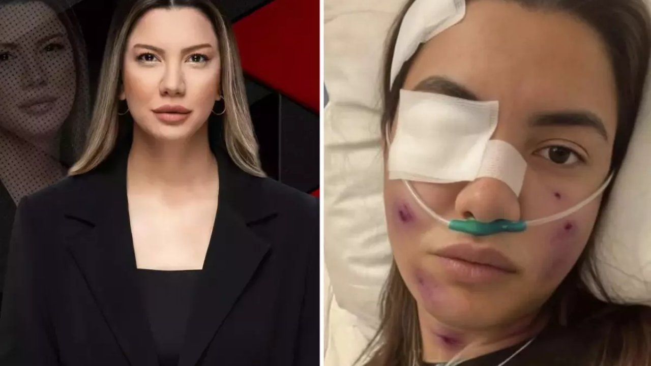 Fulya Öztürk Trafik Kazası Mı Geçirdi? Elden Ele Dolaşan Görselle İlgili Açıklama Geldi!